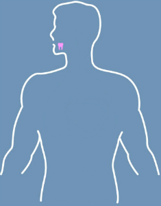 Tooth Loss graphic