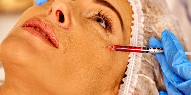  botox aging wrinkles