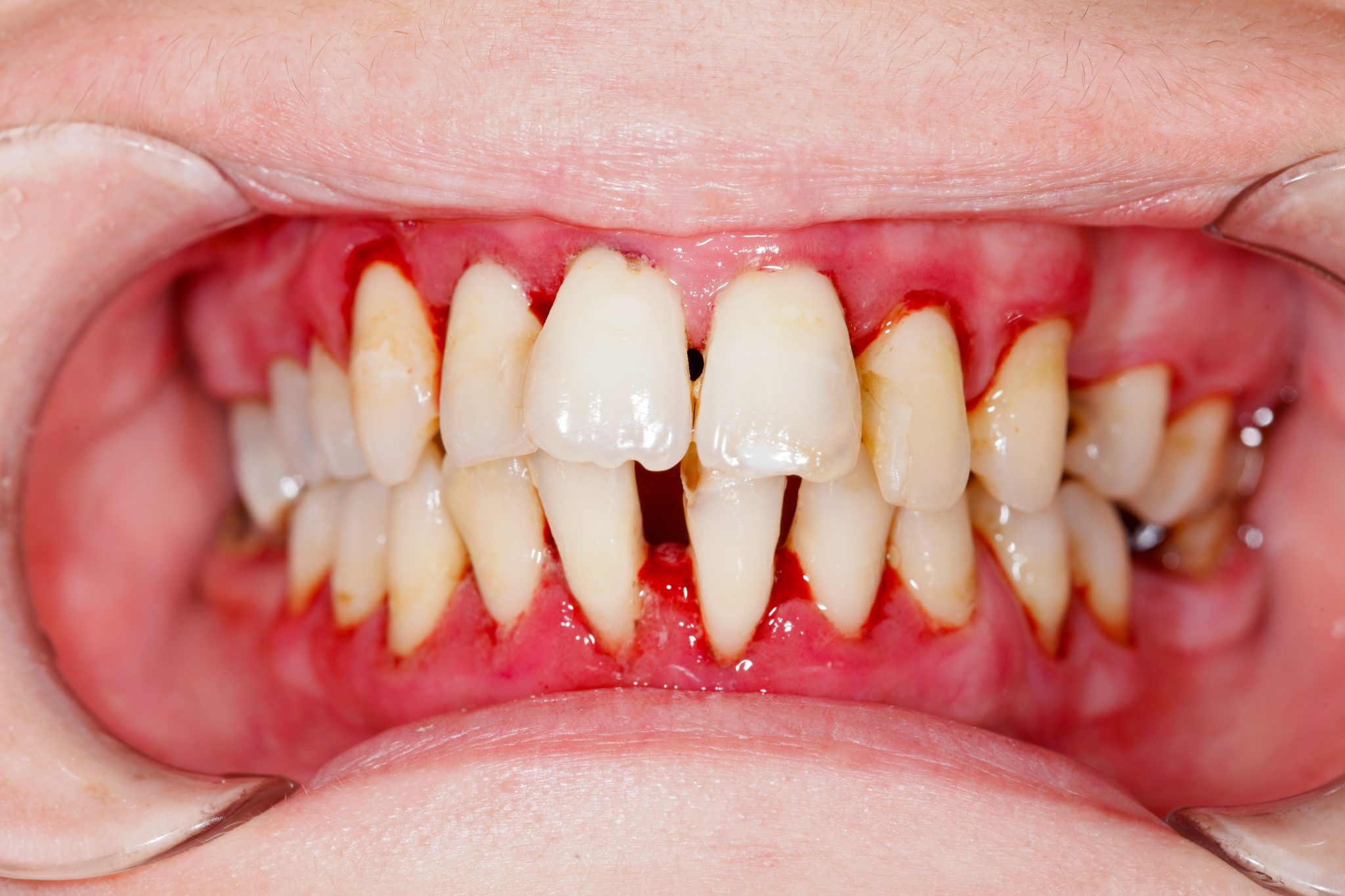 smile health dentist teeth