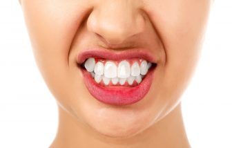 3 Cosmetic Procedures to Repair Tooth Grinding Damage