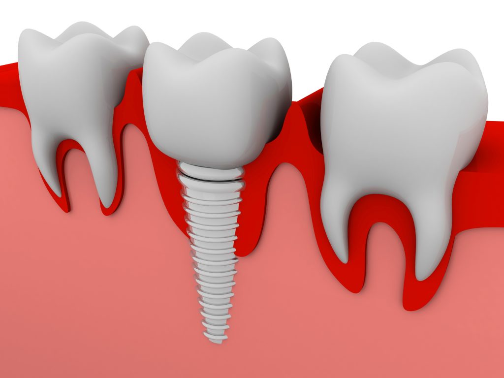 teeth, health, smile, dentist