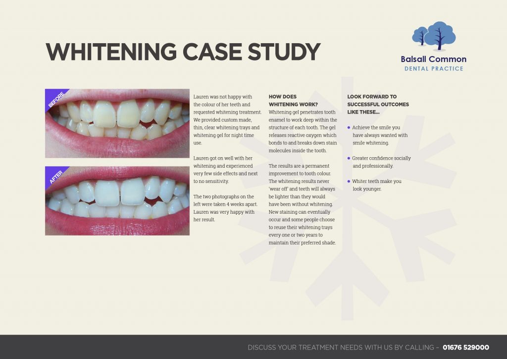 Teeth Whitening Case Study