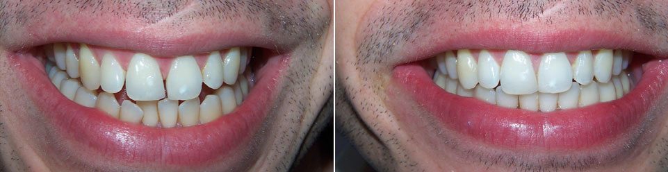 Orthodontics helps in improving your smile