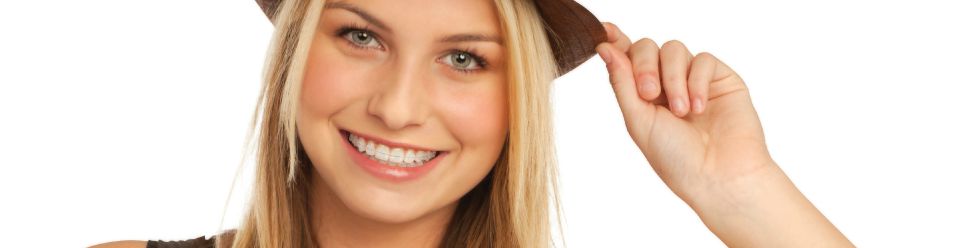 Traditional braces