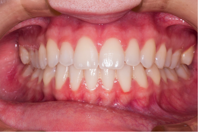oralhealth dentalhealth dentist teeth smile